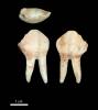 CC F5c; BBC Eland tooth